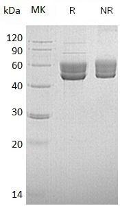 Human SERPINI2/MEPI/PI14 (His tag) recombinant protein