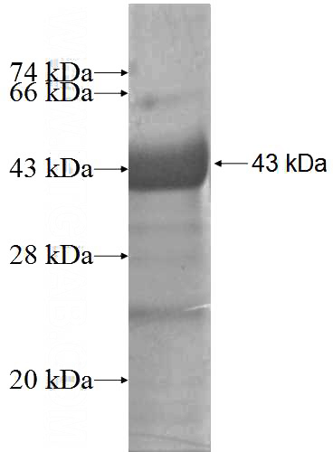 Human CLCA2 Recombinant protein (6*His tag)
