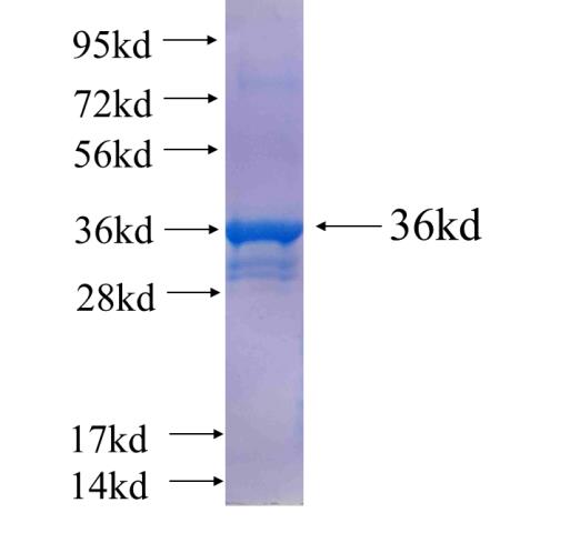 Recombinant human TIMM10(Full length) SDS-PAGE