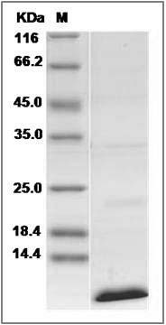 Human CD81 / TAPA-1 Protein SDS-PAGE