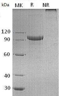 Human IL27RA/CRL1/TCCR/WSX1/UNQ296 (Fc tag) recombinant protein