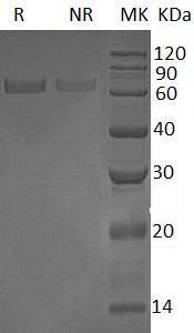Human LBP (His tag) recombinant protein