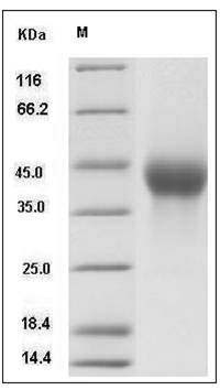 Rat CXCL16 / SR-PSOX Protein (His Tag) SDS-PAGE