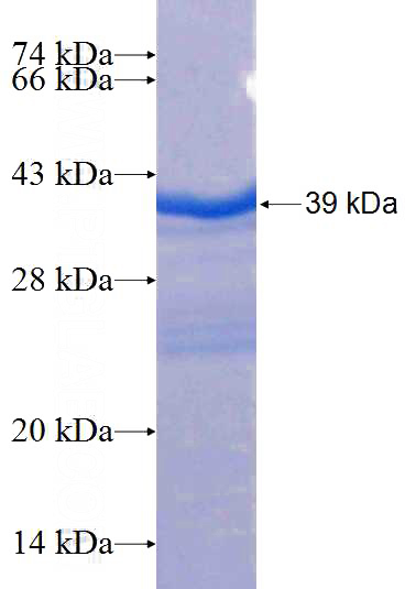 Recombinant Human KCNN4 SDS-PAGE