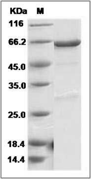 Mouse PDK4 Protein (His & GST Tag) SDS-PAGE