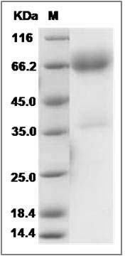 Rat CXCL16 / SR-PSOX Protein (Fc Tag) SDS-PAGE