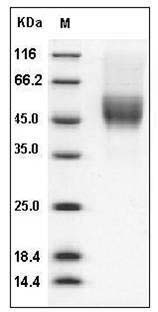 Mouse CD64 / FCGR1 Protein (His & AVI Tag) SDS-PAGE