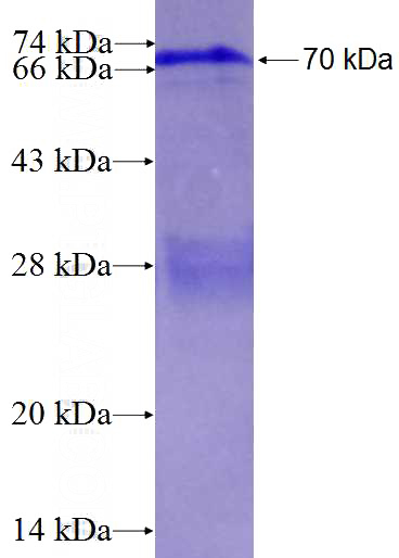 Recombinant Human ATP6V0A1 SDS-PAGE