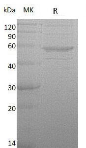 Human IL15RA (Fc tag) recombinant protein