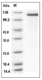 Mouse PKC delta / PRKCD Protein (His & GST Tag) SDS-PAGE