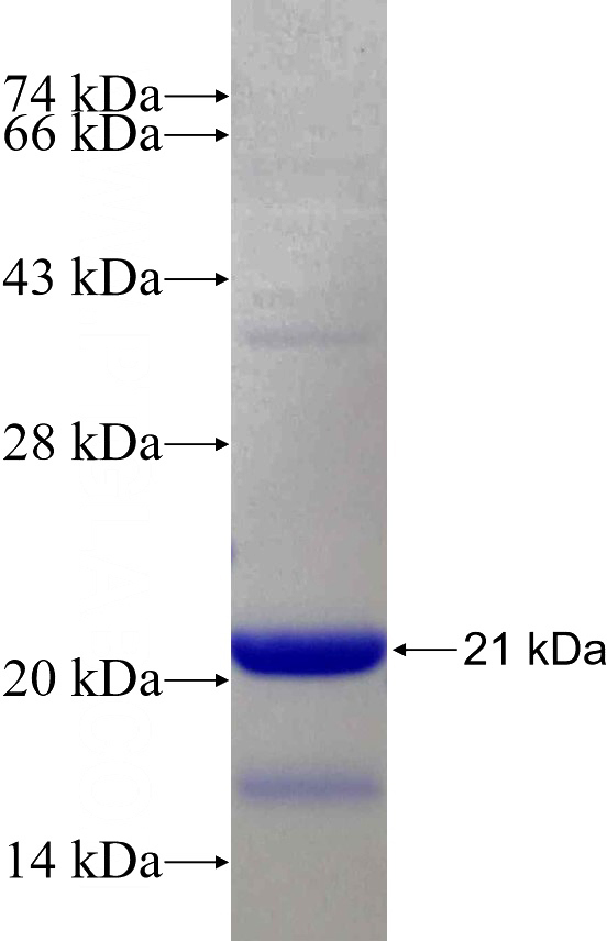 Recombinant Human STAG2 SDS-PAGE