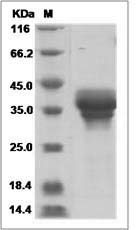 Rat STX7 / Syntaxin 7 Protein (His Tag)