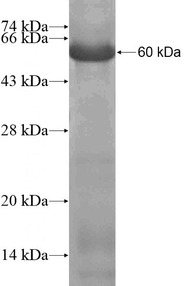 Recombinant Human ZNF335 SDS-PAGE