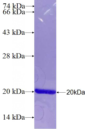 Recombinant Human BRDT SDS-PAGE