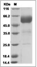 Human BTLA Protein (Fc Tag)