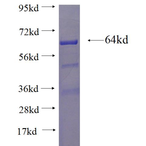 Recombinant human LONP2 SDS-PAGE