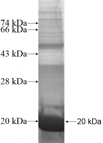 Recombinant Human FAM119A SDS-PAGE