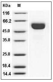Influenza A H3N2 (A/Aichi/2/1968) Hemagglutinin Protein (HA1 Subunit) (His Tag) SDS-PAGE