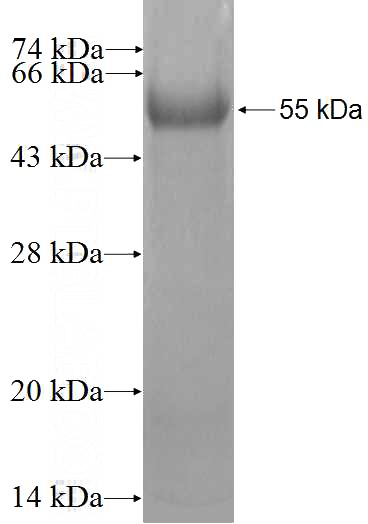 Recombinant Human PHOSPHO2 SDS-PAGE