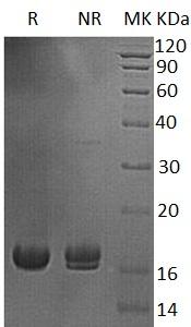 Human UBE2V1/CROC1/UBE2V/UEV1/P/OKcl.19 (His tag) recombinant protein