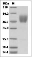 ACVR1C protein SDS-PAGE