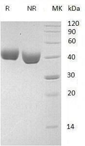Mouse Nectin2/Mph/Pvr/Pvrl2/Pvs (His tag) recombinant protein