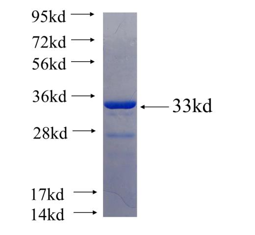 Recombinant human C20orf11 SDS-PAGE