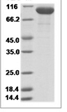 Human complement factor B Protein 15477