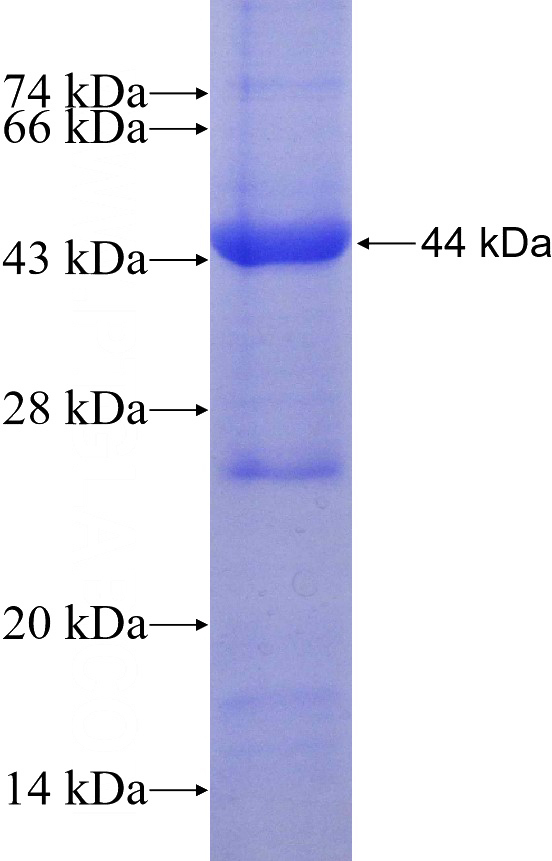 Recombinant Human IGSF21 SDS-PAGE