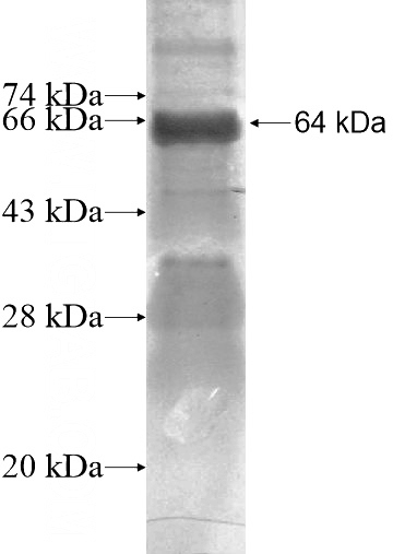 Recombinant Human ANKMY2 SDS-PAGE