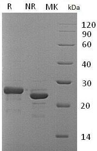 Human FGF19/UNQ334/PRO533 (His tag) recombinant protein