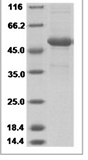 Human TNFSF14/LIGHT/CD258 Protein 14123