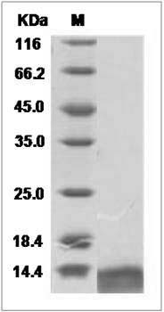 Human CCL13 / MCP-4 Protein (His Tag) SDS-PAGE