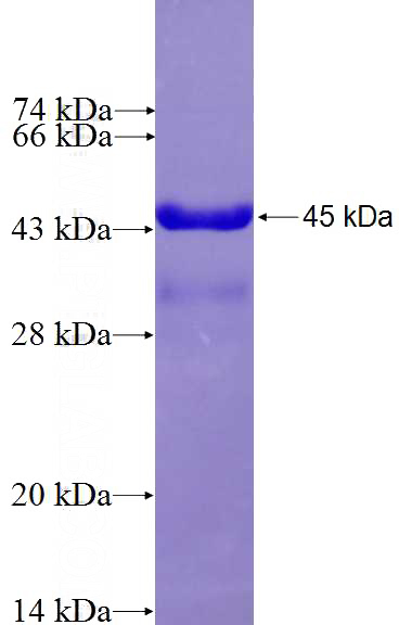 Recombinant Human ABCC8 SDS-PAGE