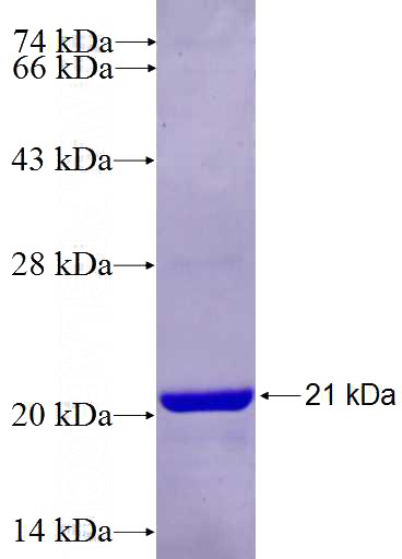 Recombinant Human C15orf24 SDS-PAGE