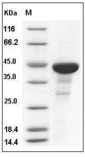 Human CDC42 / G25K Protein (GST Tag) SDS-PAGE