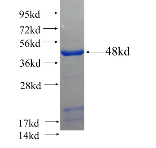 Recombinant human ZMYND12 SDS-PAGE