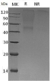 Human BGN/SLRR1A (His tag) recombinant protein