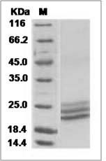 Human APOM Protein (His Tag) SDS-PAGE
