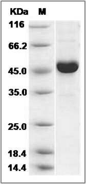 Human CRIP2 Protein (His & GST Tag) SDS-PAGE