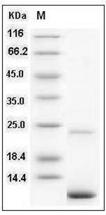Human S100A11 / S100C Protein SDS-PAGE
