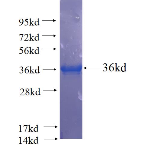 Recombinant human ARVCF SDS-PAGE