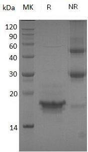 Human CD3E/T3E (His tag) recombinant protein