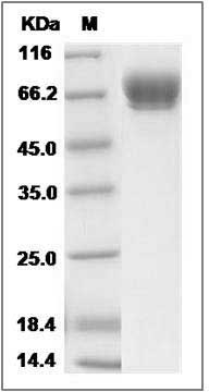 Cynomolgus ALCAM Protein (His Tag) SDS-PAGE