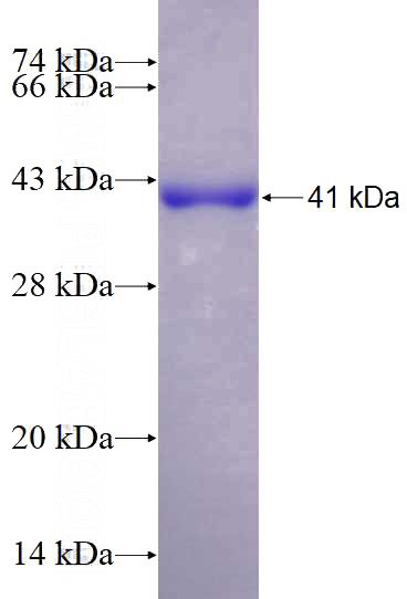 Recombinant Human BDH1 SDS-PAGE