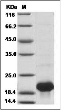 Mouse IL36G / IL1F9 Protein (His Tag) SDS-PAGE