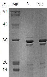 Human AMELX/AMG/AMGX (His tag) recombinant protein