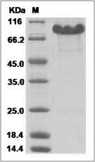 Mouse CRELD2 Protein (Fc Tag) SDS-PAGE