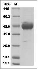 Influenza A H7N8 (A/mallard/Netherlands/33/2006) Hemagglutinin / HA1 Protein (His Tag)