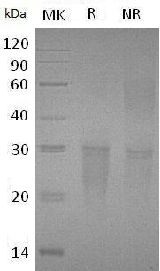 Human TMIGD2/CD28H/IGPR1/UNQ3059/PRO9879 (His tag) recombinant protein